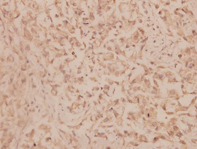 MMP19 Antibody in Immunohistochemistry (Paraffin) (IHC (P))