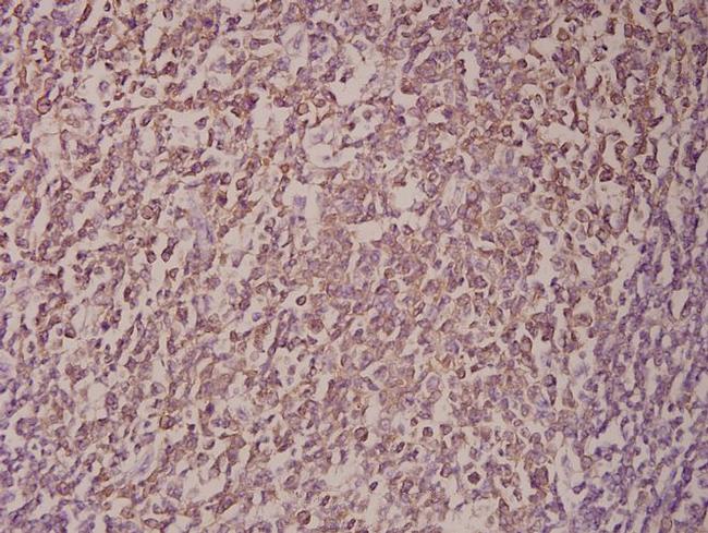 p14ARF Antibody in Immunohistochemistry (Paraffin) (IHC (P))