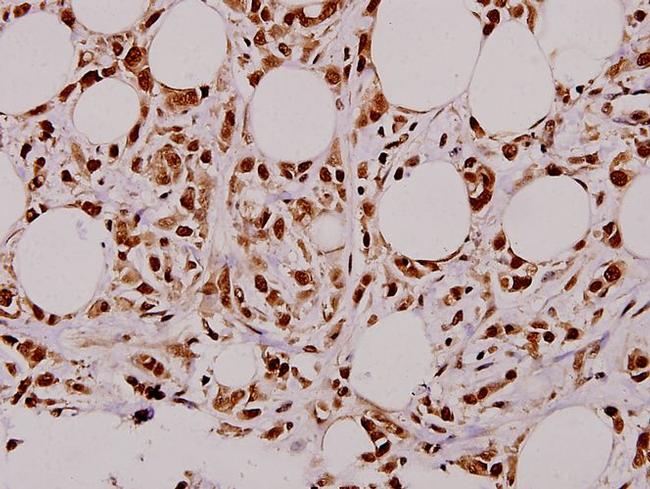 STAT3 Antibody in Immunohistochemistry (Paraffin) (IHC (P))