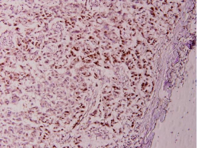 STAT6 Antibody in Immunohistochemistry (Paraffin) (IHC (P))