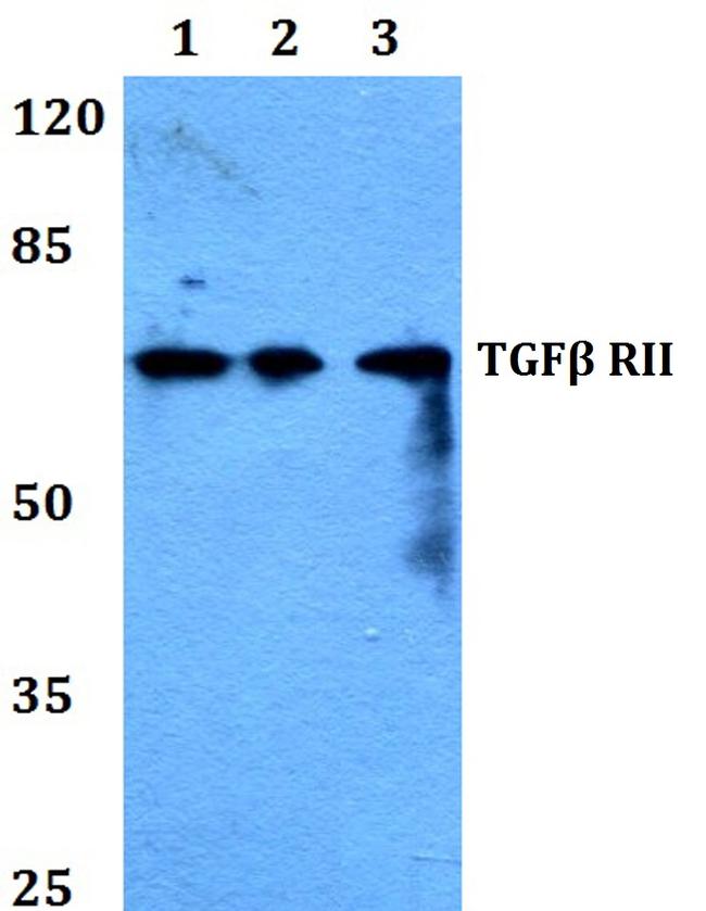 TGFBR2 Antibody in Western Blot (WB)