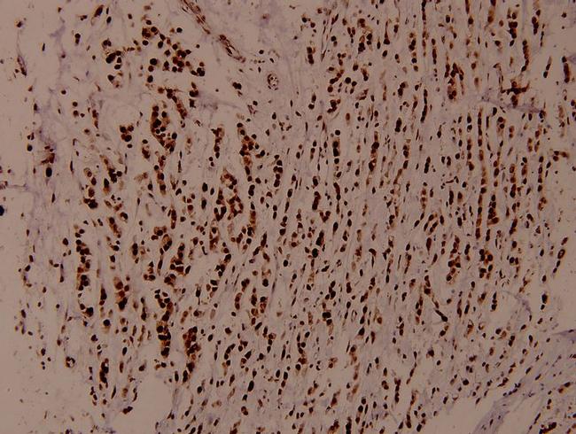 WNK1 Antibody in Immunohistochemistry (Paraffin) (IHC (P))