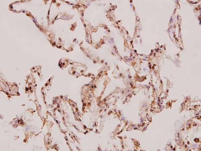 Caspase 8 Antibody in Immunohistochemistry (Paraffin) (IHC (P))