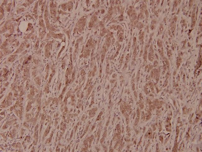 GSK3B Antibody in Immunohistochemistry (Paraffin) (IHC (P))