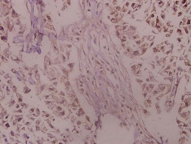 TrkA Antibody in Immunohistochemistry (Paraffin) (IHC (P))