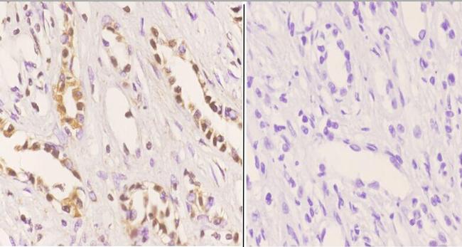 MDM2 Antibody in Immunohistochemistry (Paraffin) (IHC (P))