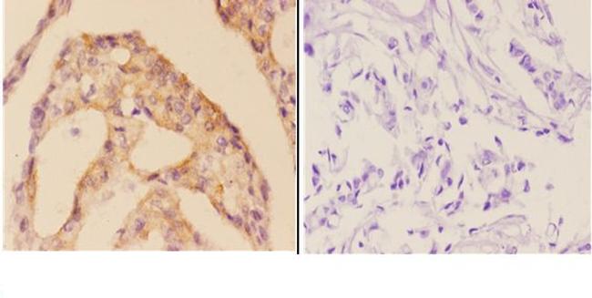 Cardiac Troponin I Antibody in Immunohistochemistry (Paraffin) (IHC (P))