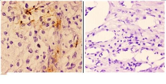 Cardiac Troponin I Antibody in Immunohistochemistry (Paraffin) (IHC (P))