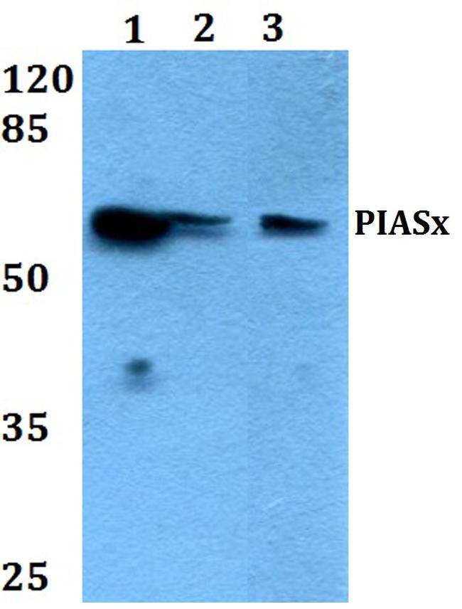 PIAS2 Antibody in Western Blot (WB)