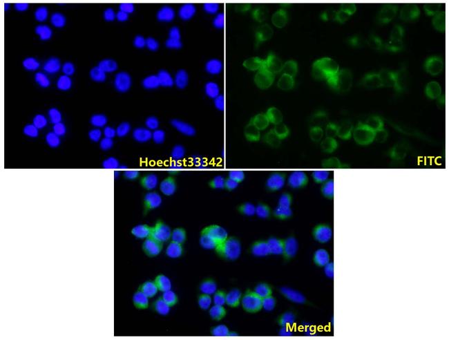 Tyrosinase Antibody in Immunocytochemistry (ICC/IF)