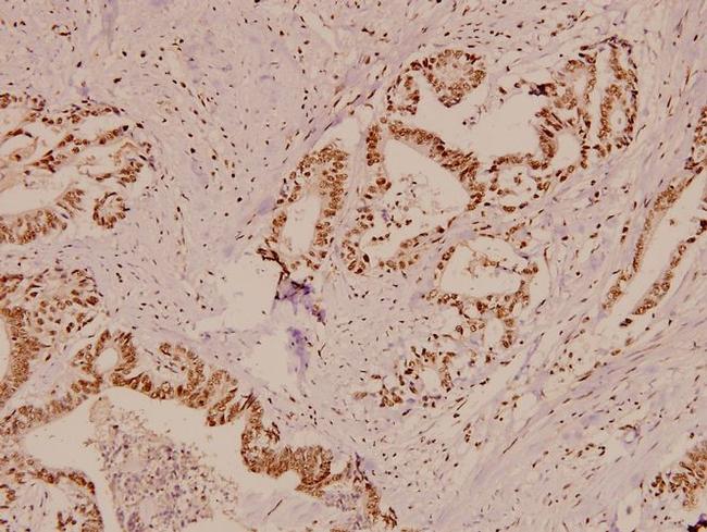 Protein APC Antibody in Immunohistochemistry (Paraffin) (IHC (P))