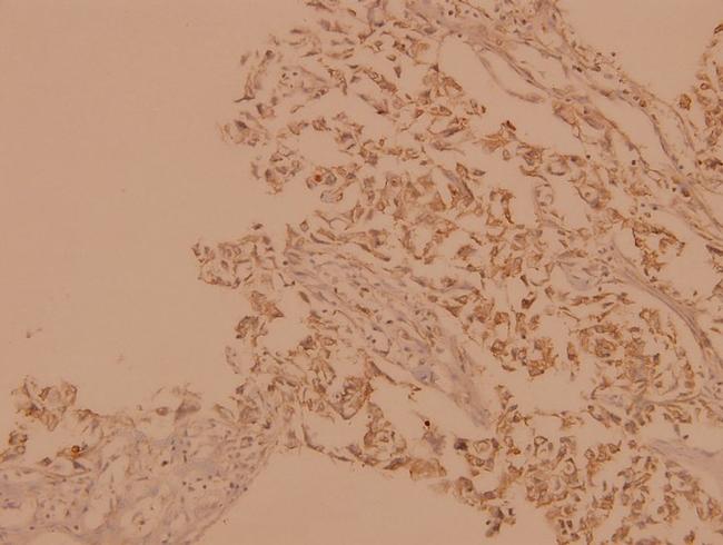 A-Raf Antibody in Immunohistochemistry (Paraffin) (IHC (P))