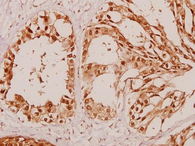 beta Arrestin 1 Antibody in Immunohistochemistry (Paraffin) (IHC (P))