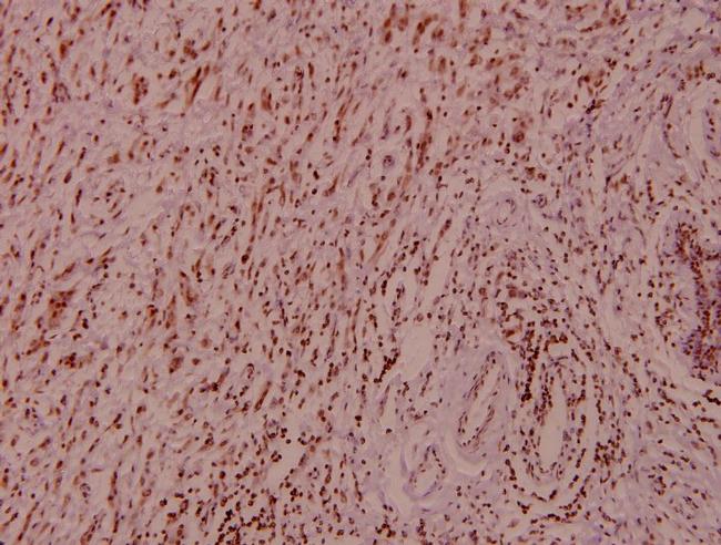 B-Raf Antibody in Immunohistochemistry (Paraffin) (IHC (P))