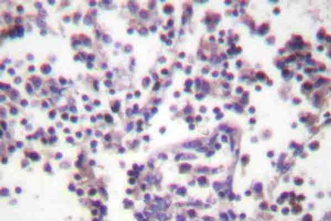 Caspase 3 Antibody in Immunohistochemistry (Paraffin) (IHC (P))