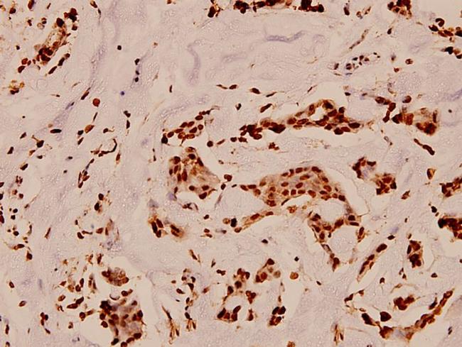 GP130 Antibody in Immunohistochemistry (Paraffin) (IHC (P))