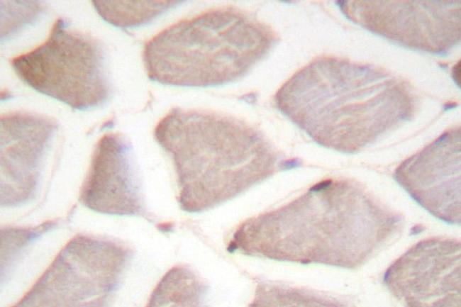 CHOP Antibody in Immunohistochemistry (Paraffin) (IHC (P))