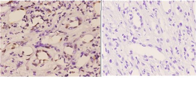 ETS1 Antibody in Immunohistochemistry (Paraffin) (IHC (P))