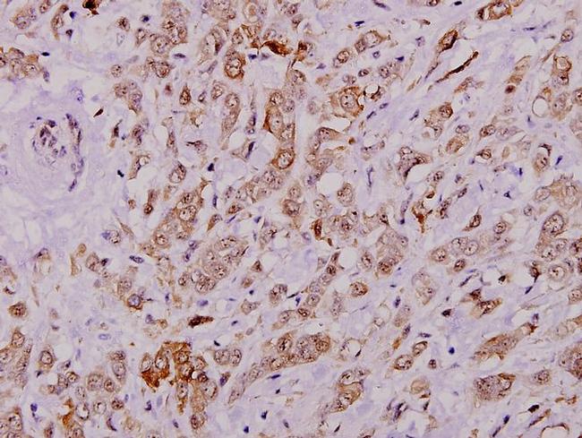 Cytokeratin 8 Antibody in Immunohistochemistry (Paraffin) (IHC (P))