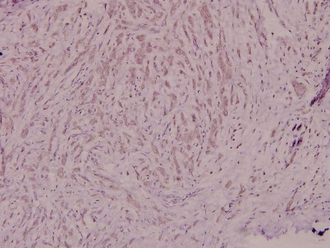 NCF4 Antibody in Immunohistochemistry (Paraffin) (IHC (P))