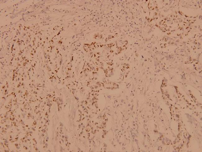 PBK Antibody in Immunohistochemistry (Paraffin) (IHC (P))