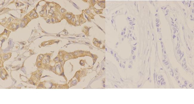 PRKD2 Antibody in Immunohistochemistry (Paraffin) (IHC (P))