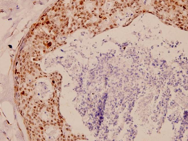 TK1 Antibody in Immunohistochemistry (Paraffin) (IHC (P))