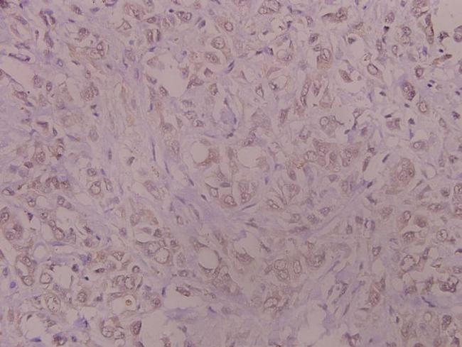 Catalase Antibody in Immunohistochemistry (Paraffin) (IHC (P))