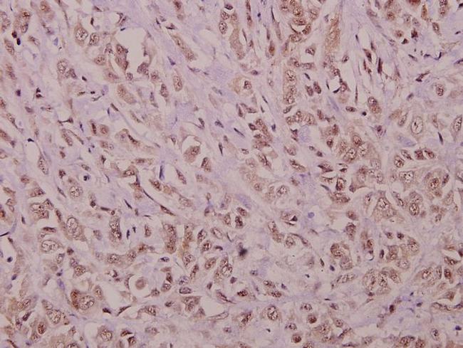 YAP1 Antibody in Immunohistochemistry (Paraffin) (IHC (P))