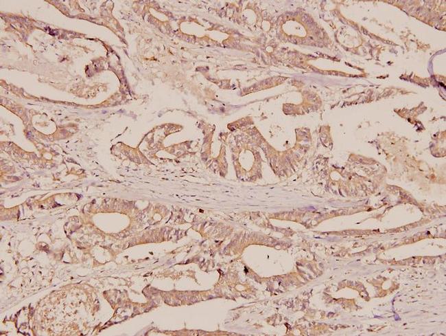 ERAB Antibody in Immunohistochemistry (Paraffin) (IHC (P))