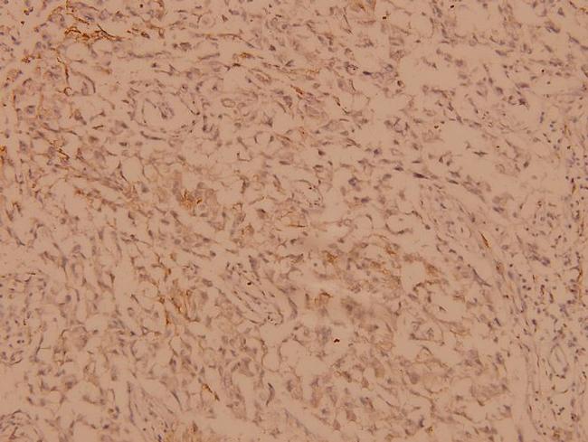 hnRNP C Antibody in Immunohistochemistry (Paraffin) (IHC (P))