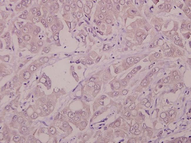 IFNAR1 Antibody in Immunohistochemistry (Paraffin) (IHC (P))