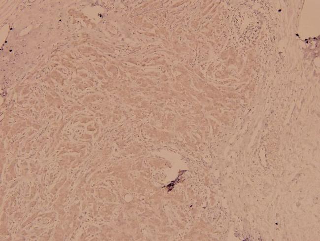 FGFR1 Antibody in Immunohistochemistry (Paraffin) (IHC (P))