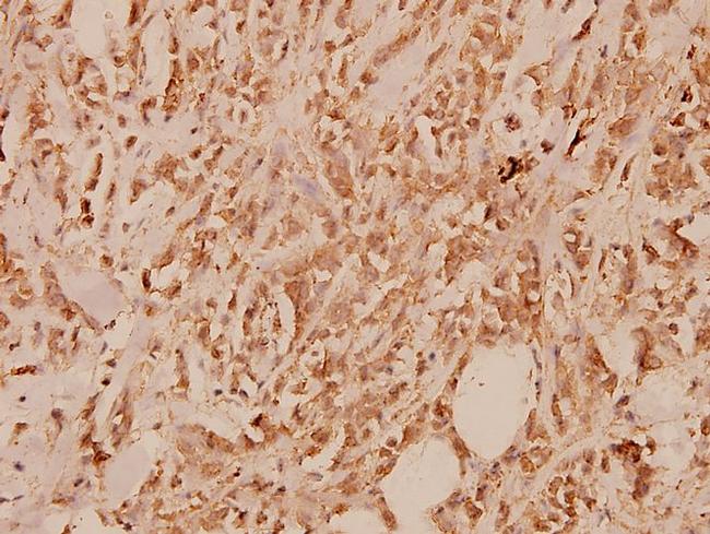 IL13RA1 Antibody in Immunohistochemistry (Paraffin) (IHC (P))