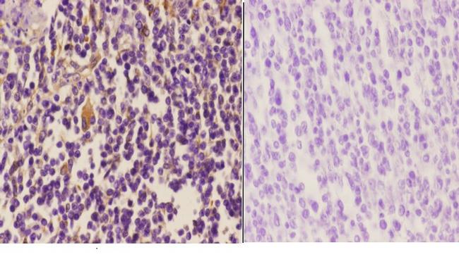 Vimentin Antibody in Immunohistochemistry (Paraffin) (IHC (P))