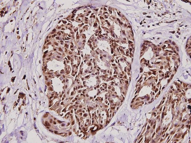 TPT1 Antibody in Immunohistochemistry (Paraffin) (IHC (P))