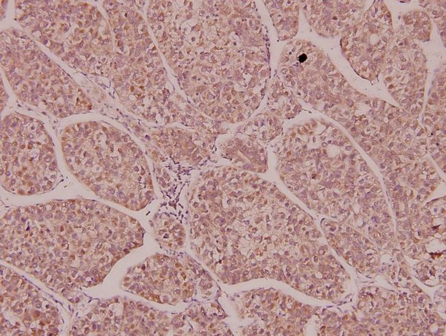 EphA1 Antibody in Immunohistochemistry (Paraffin) (IHC (P))