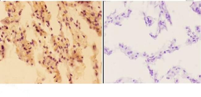 APE1 Antibody in Immunohistochemistry (Paraffin) (IHC (P))