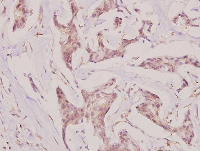 CMPK1 Antibody in Immunohistochemistry (Paraffin) (IHC (P))