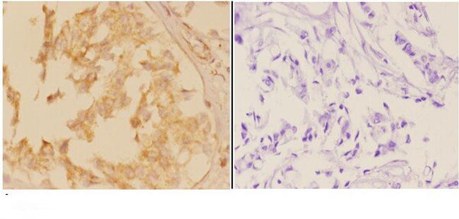 ACVR1B Antibody in Immunohistochemistry (Paraffin) (IHC (P))