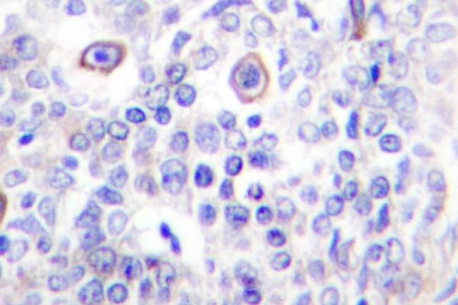 CD83 Antibody in Immunohistochemistry (Paraffin) (IHC (P))