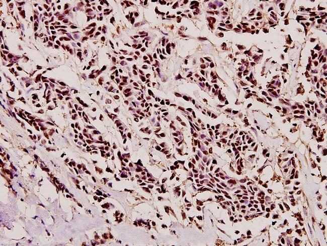 PYCARD Antibody in Immunohistochemistry (Paraffin) (IHC (P))