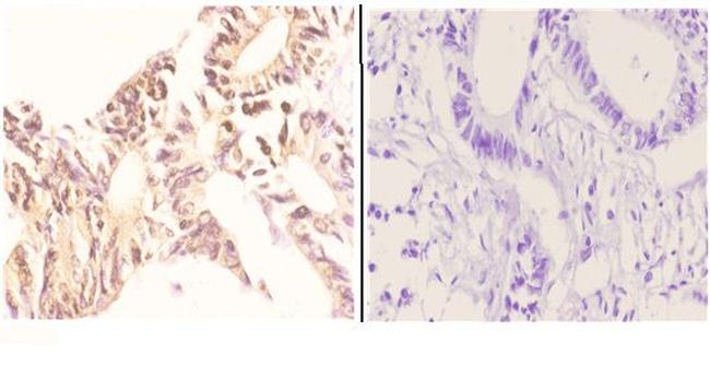 NBS1 Antibody in Immunohistochemistry (Paraffin) (IHC (P))