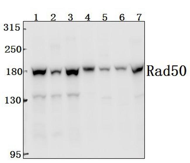 RAD50 Antibody in Immunohistochemistry (Paraffin) (IHC (P))