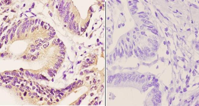 TBP Antibody in Immunohistochemistry (Paraffin) (IHC (P))