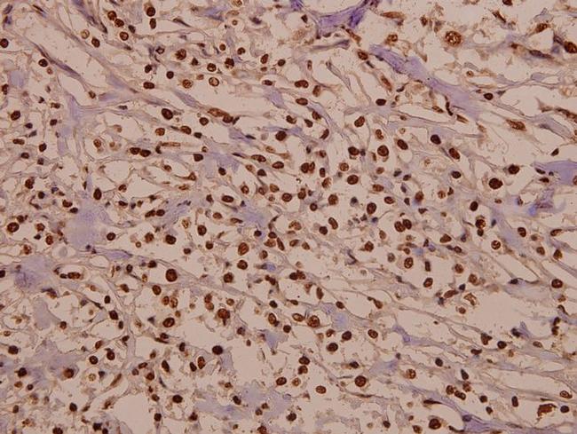 CDK2 Antibody in Immunohistochemistry (Paraffin) (IHC (P))