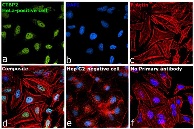 CtBP2 Antibody in Immunocytochemistry (ICC/IF)