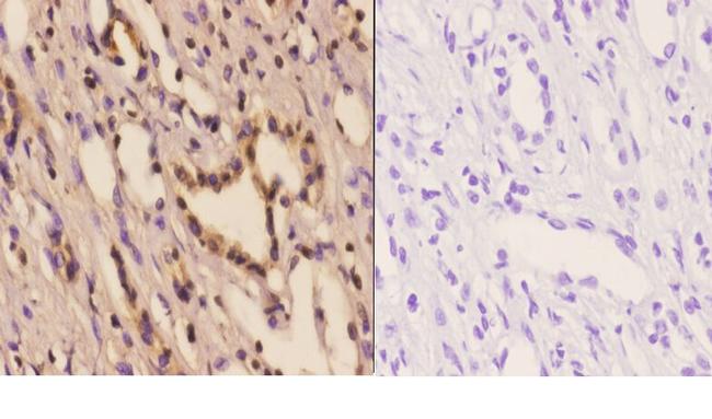 PFKP Antibody in Immunohistochemistry (Paraffin) (IHC (P))