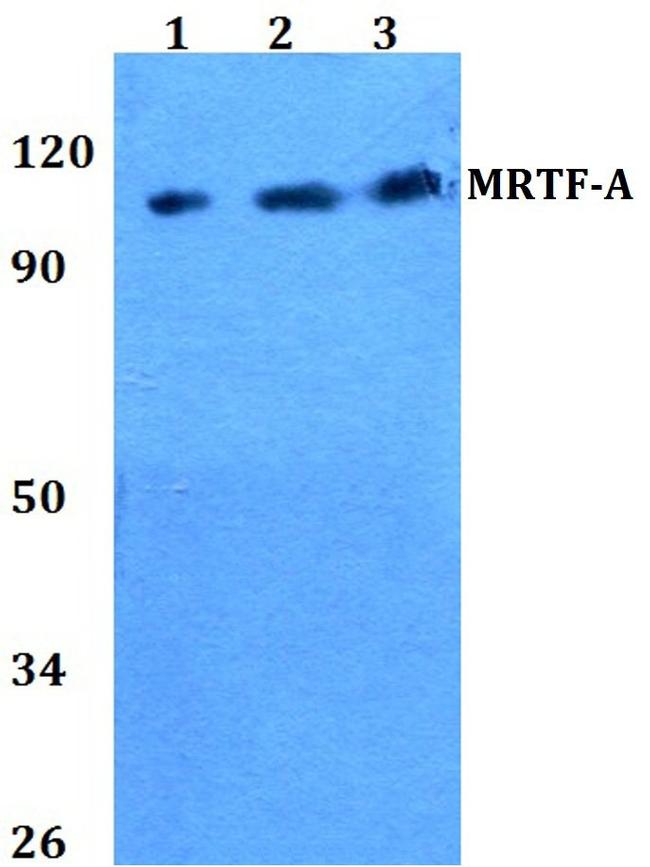 MKL1 Antibody in Western Blot (WB)