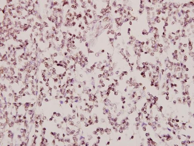 beta-2 Adrenergic Receptor Antibody in Immunohistochemistry (Paraffin) (IHC (P))